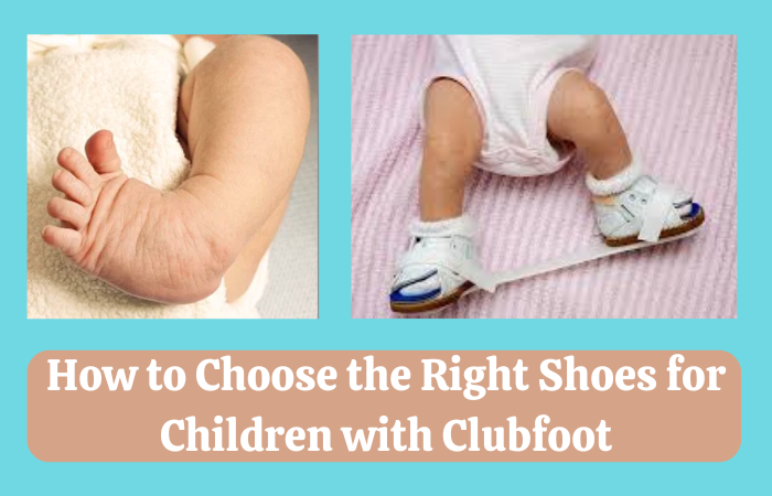 How to Choose the Right Shoes for Children with Clubfoot