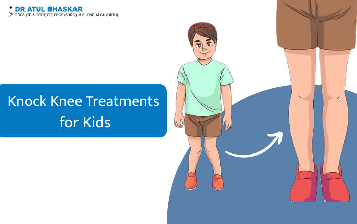 Effective Treatments for Knock Knees in Growing Children