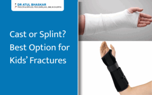 Cast vs. Splint for Child Fractures: What’s the Right Option?