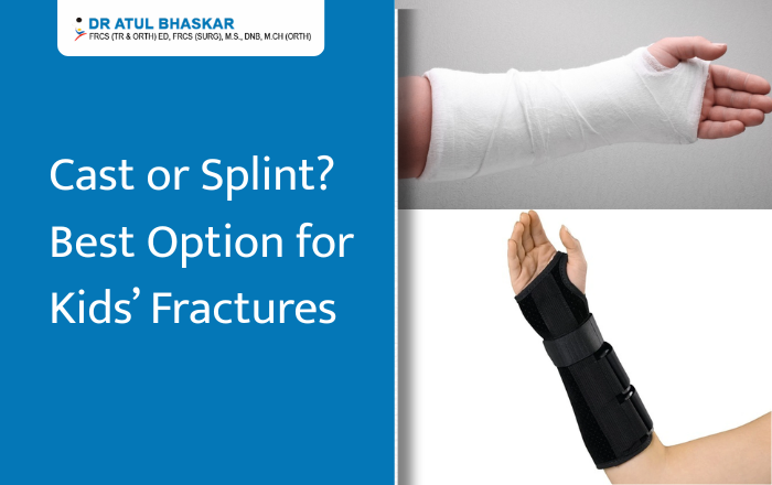 Cast vs. Splint for Child Fractures: What’s the Right Option?