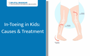 Pigeon Toes in Children: What Causes In-Toeing and How to Treat It