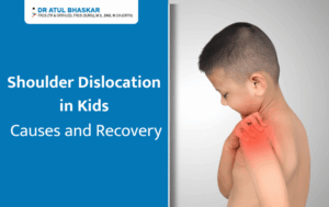 Shoulder Dislocation in Kids: Causes, Symptoms, and Recovery Timeline