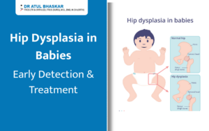 Hip Dysplasia in Babies: Early Identification & Treatment Guide for Parents
