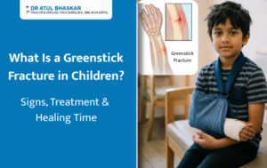 What Is a Greenstick Fracture in Children? Signs, Treatment & Healing Time