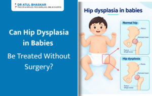 Can Hip Dysplasia in Babies Be Treated Without Surgery?